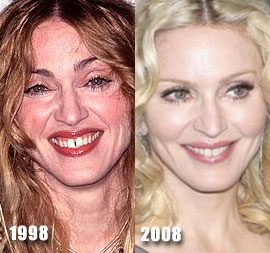 Madonna Fat