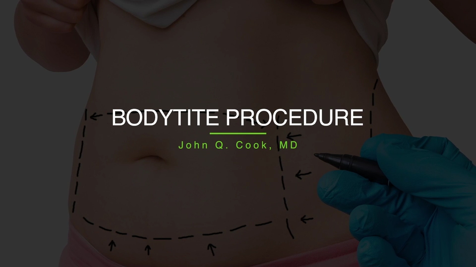 Liposuction, Coolsculpting, & BodyTite